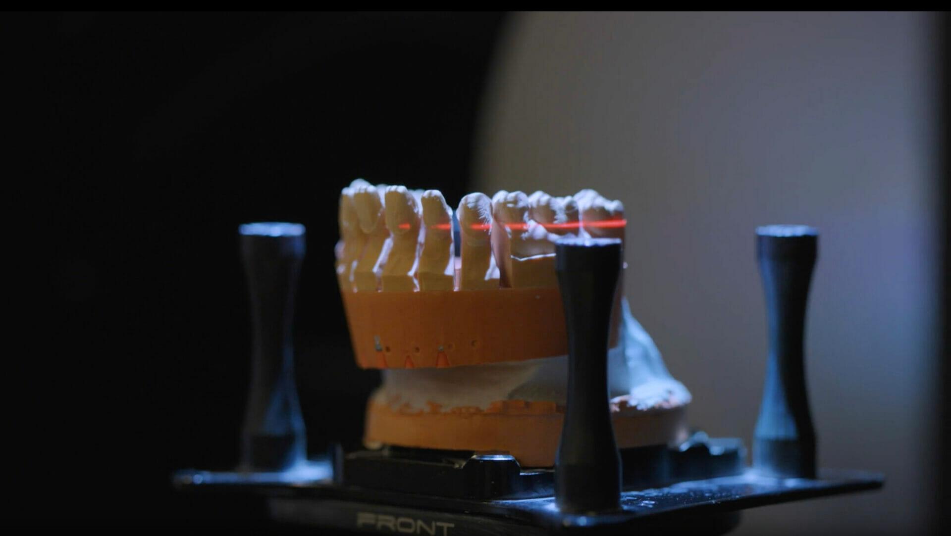 sånn lager vi tenner