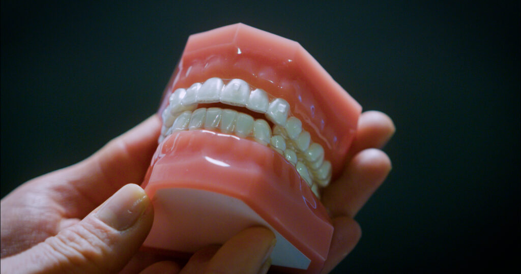 Modell av tenner med gjennomsiktige skinner på.