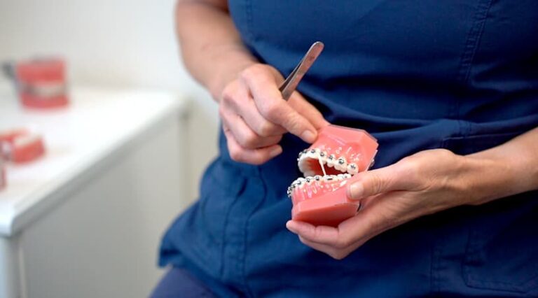 Enkle tips og løsninger for vanlige problemer med tannregulering